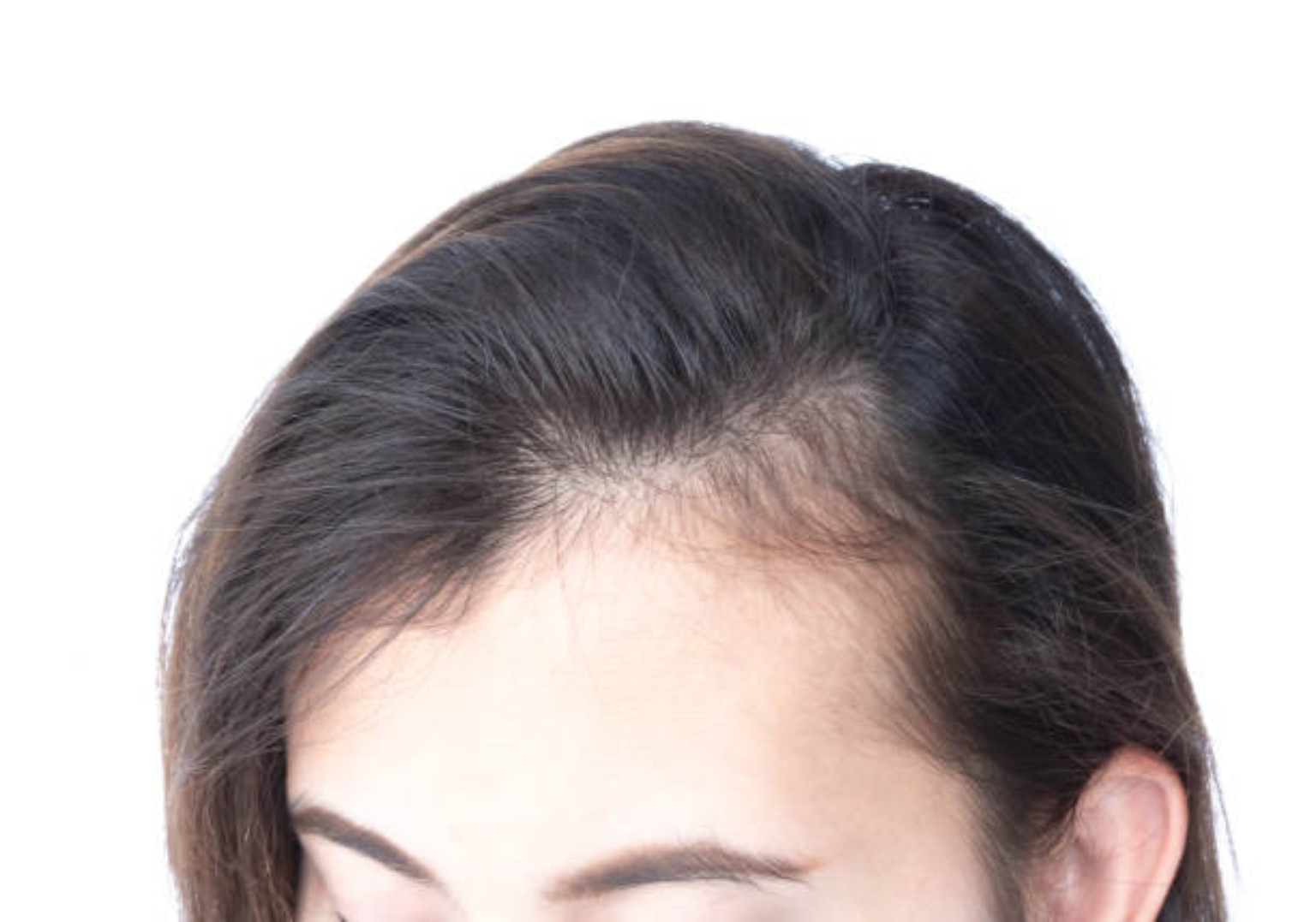 Hair Growth